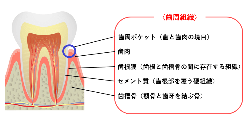 歯周病の原因とは？予防方法を知って歯肉炎や歯周炎を阻止しよう！